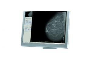 Маммограф МР-«Диамант» (аналоговый, цифровой)